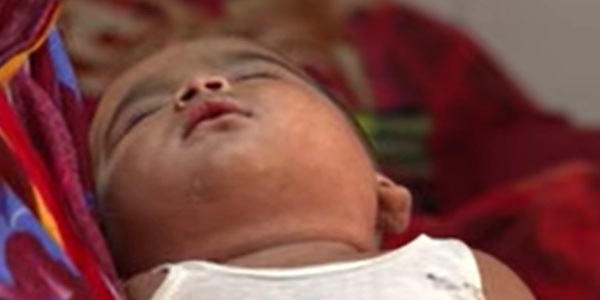 561_BD measles 2.jpg